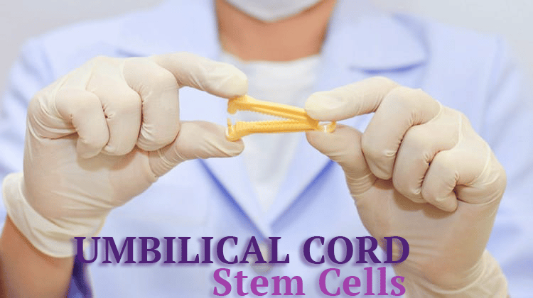 Umbilical Cord Stem Cells Therapy