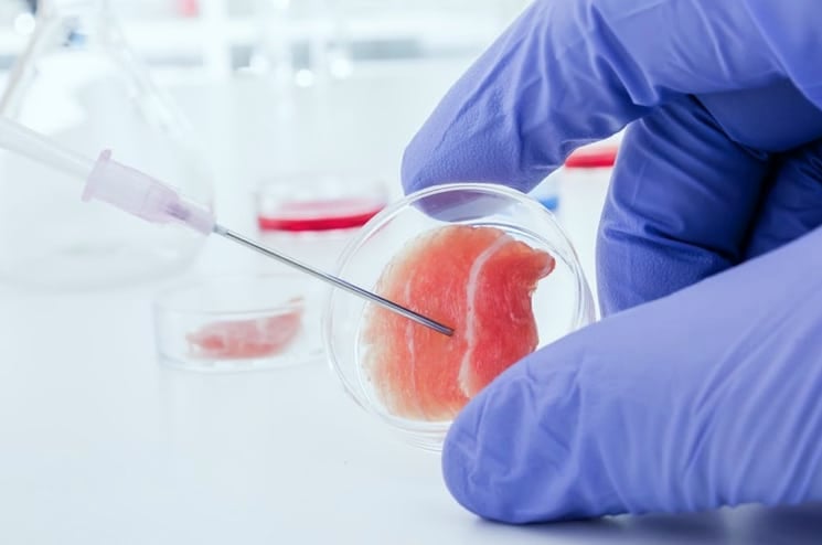 Stem Cell Therapy 3 Stem Cells Adipose derived MSCs Costa Rica - Stem Cells Costa Rica