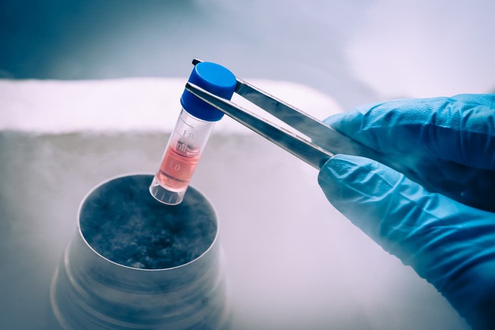 Stem Cell Therapy 2 Stem Cells Bone Marrow Stem Cell Therapy - Stem Cells Costa Rica