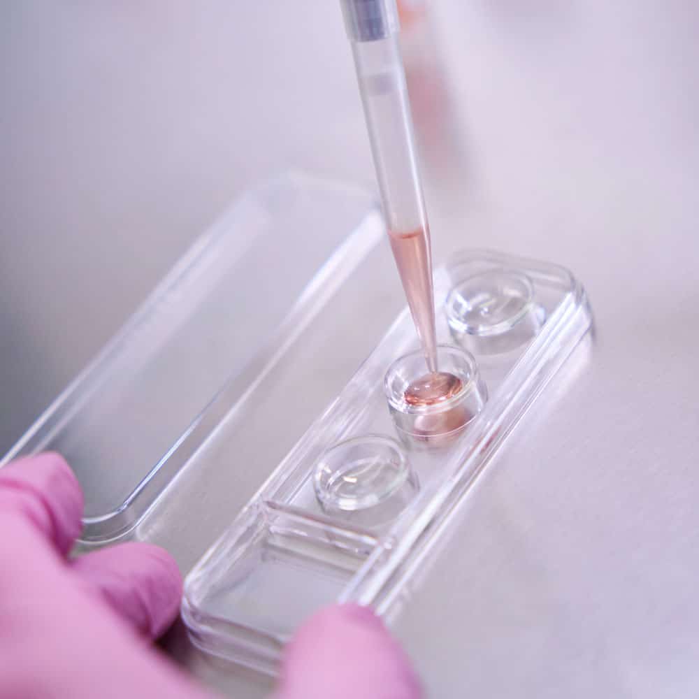 doctor transferring liquid into cell dish with precision - Stem Cells Costa Rica